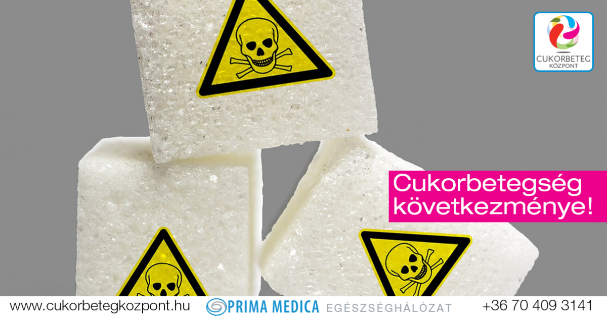 folk kezelés a cukorbetegség cukor cukorbetegség 2 típusú népi kezelés