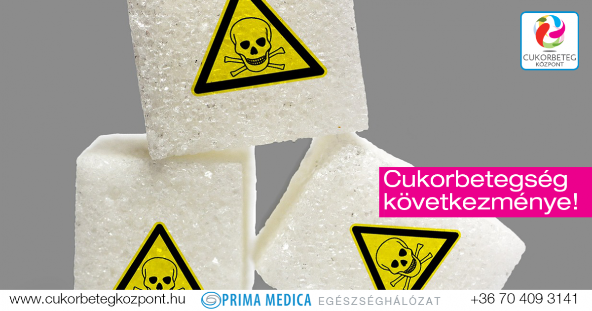 vérkárosodás a lábakban cukorbetegséggel sugar cukorbetegség-komplikációk kezelése