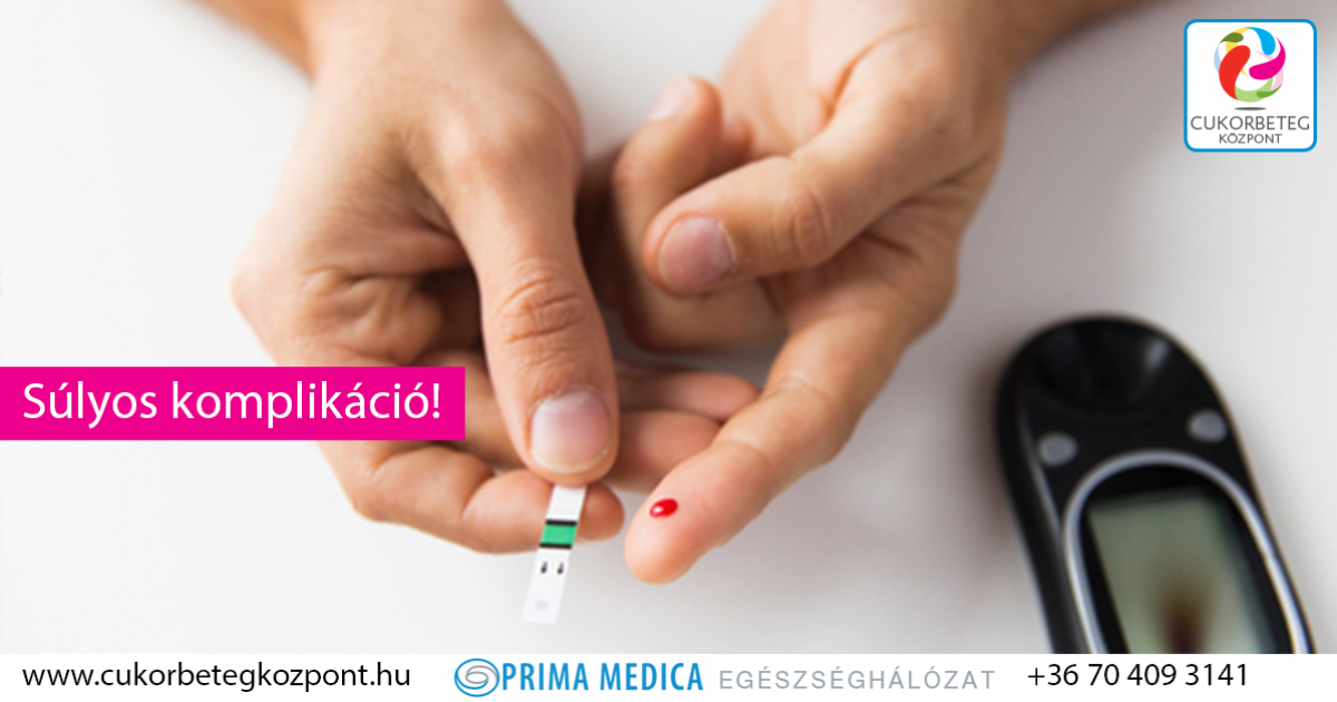 ajánlások kezelésére és diagnosztizálására cukorbetegség 2021