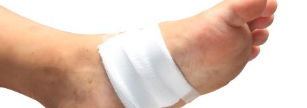 Diabéteszes lábnál az otthoni és az orvosi kezelés is elengedhetetlen