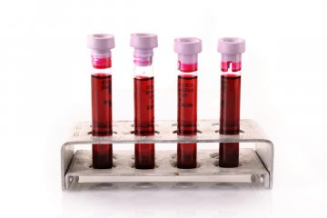 Ezért fontos a HbA1c érték vizsgálata cukorbetegség esetén
