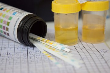 Keton a vizeletben terhesség során- aggódjak?