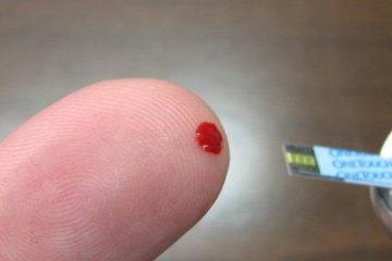 Metformin- a fogyásban is segíti a cukorbetegeket