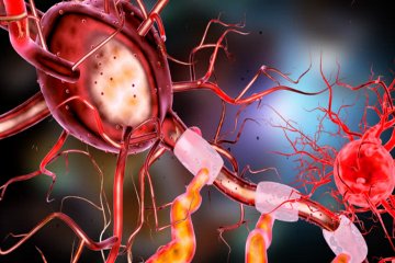 Neuropátia- a cukorbetegek csaknem felét érinti! Ön is közéjük tartozik?