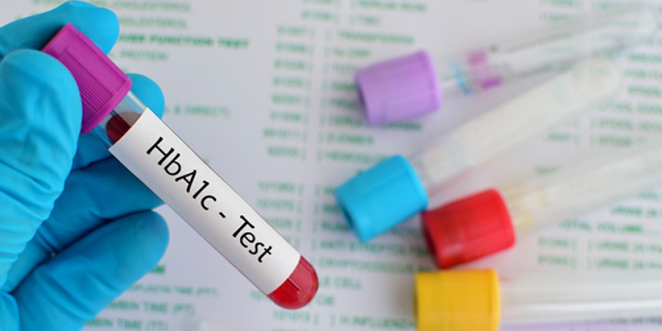 cukorbetegség laborvizsgálatok nemzetközi protokoll magas vérnyomás kezelésére diabetes