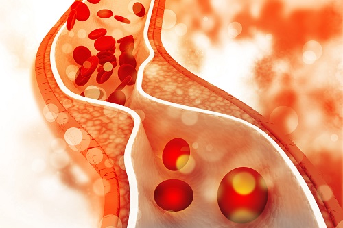 a legújabb technológia az 1. típusú diabetes mellitus kezelésében